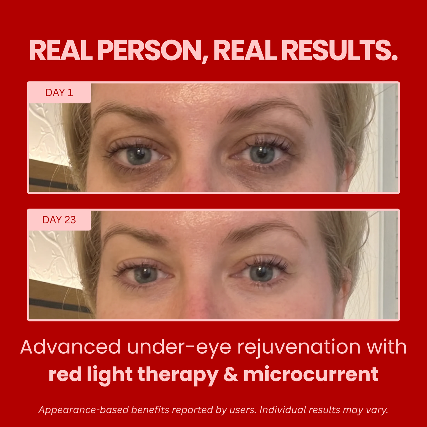 Radiance Redlight + Microcurrent Lenses