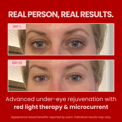 Radiance Redlight + Microcurrent Lenses